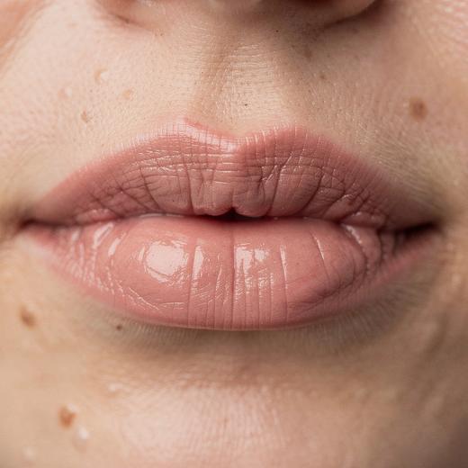 Healed lips example