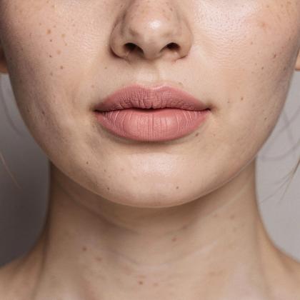 Healed lip blush example
